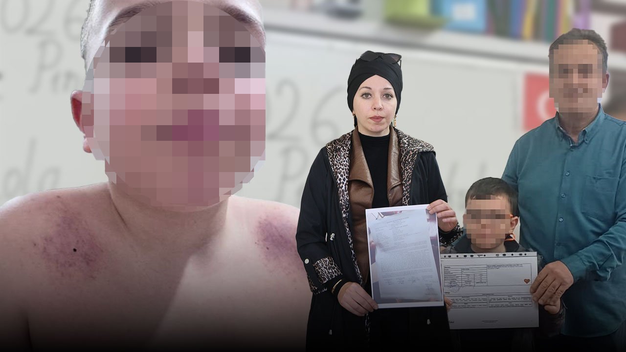Antalya'da öğrenciye darp iddiası: Anne öğretmenden şikayetçi oldu!