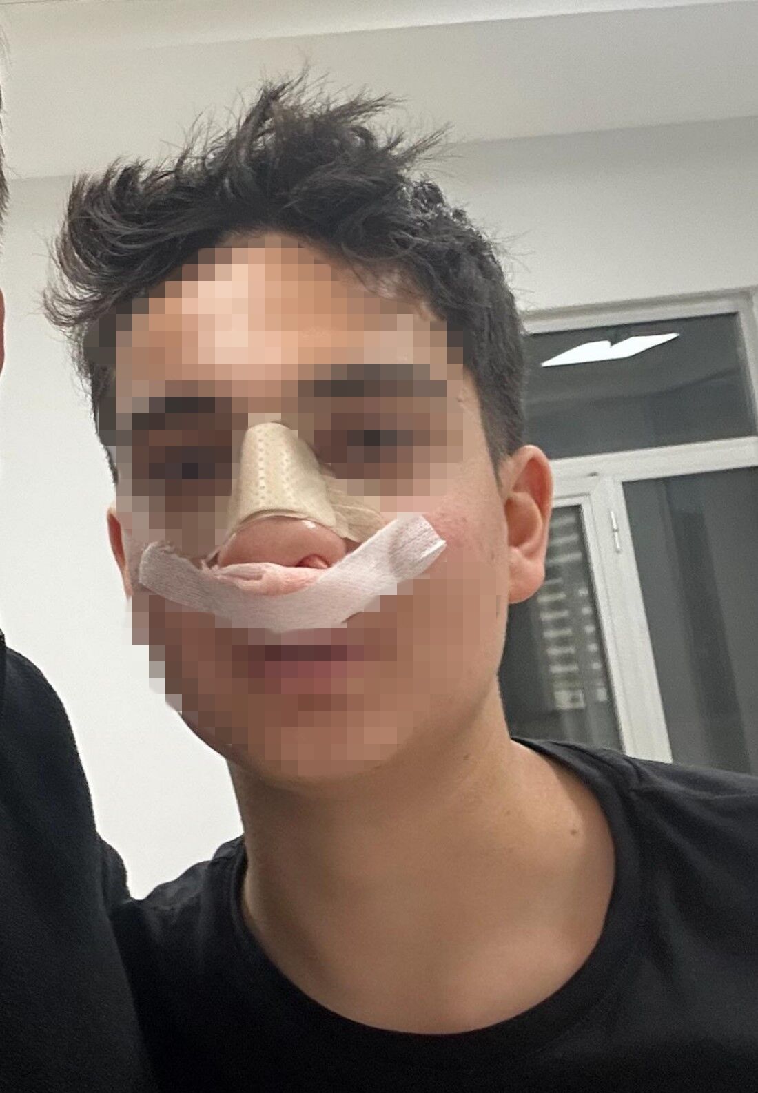 Antalya’da ‘Neden Bakıyorsun?’ Diyerek Da5