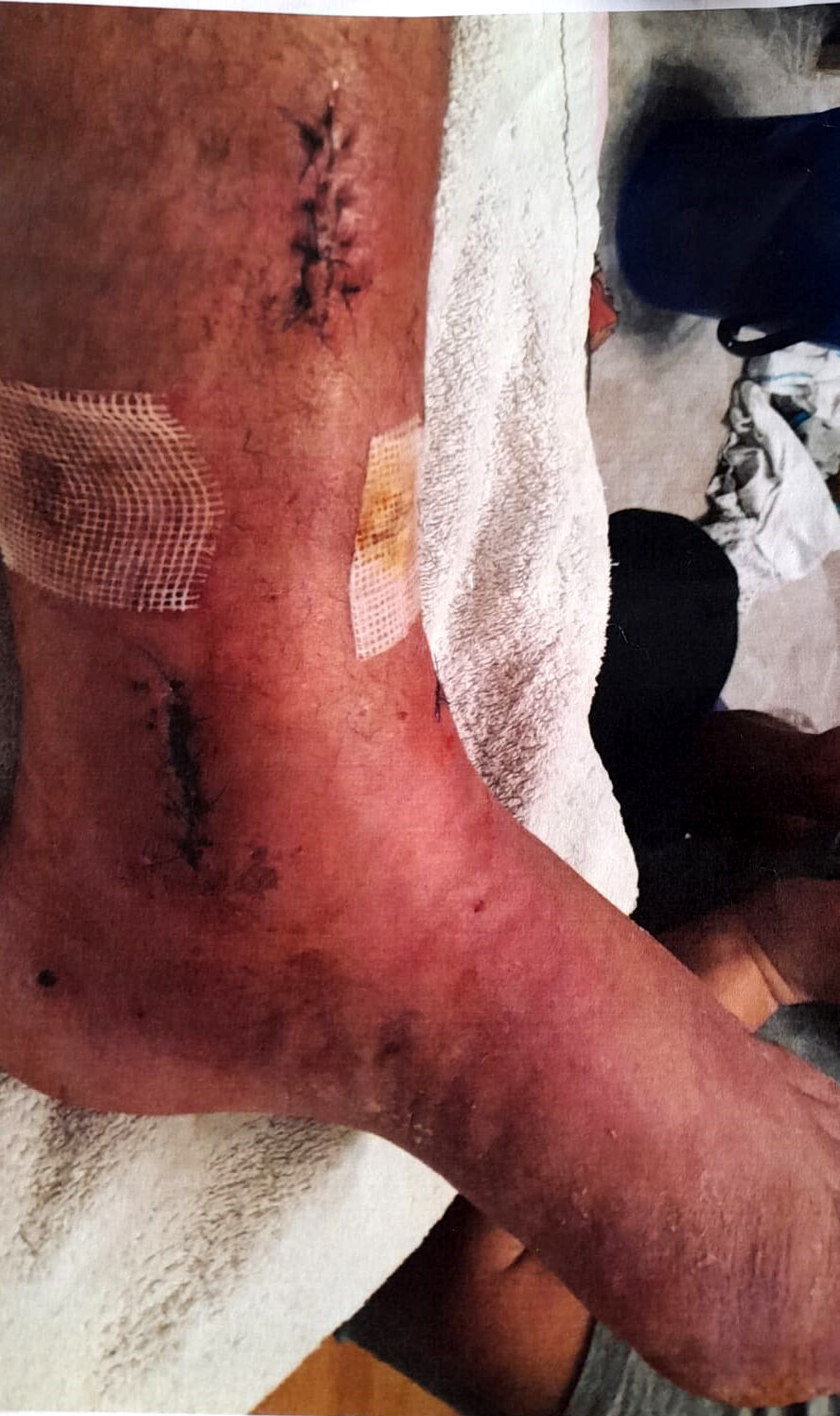 Arkeolojik Kazi Alanindaki Cukura Dustu3