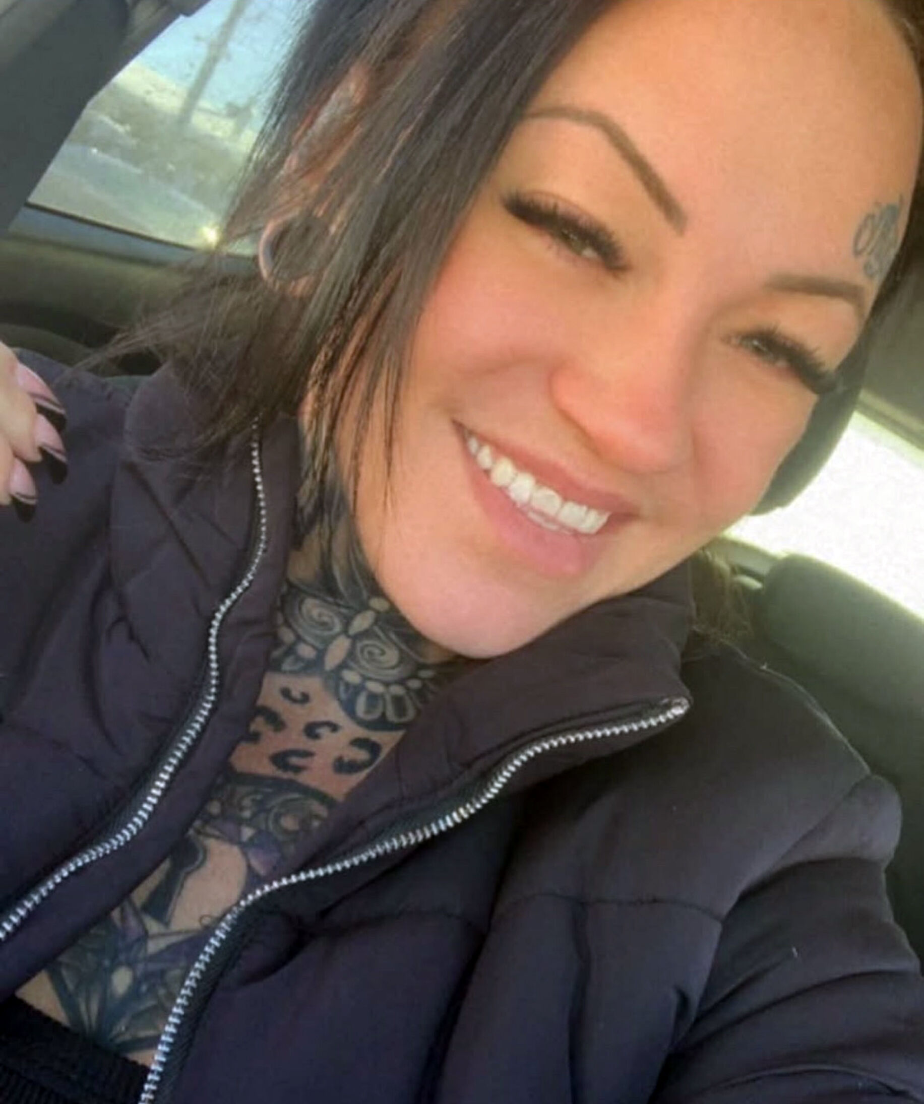 Göğüs Ve Karın Gerdirme Süpheli Ölüm2