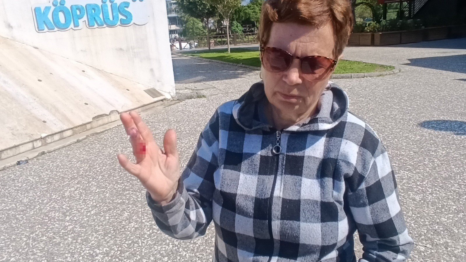 Antalya'da Evcil Köpek Sahibini Hastanelik Etti2