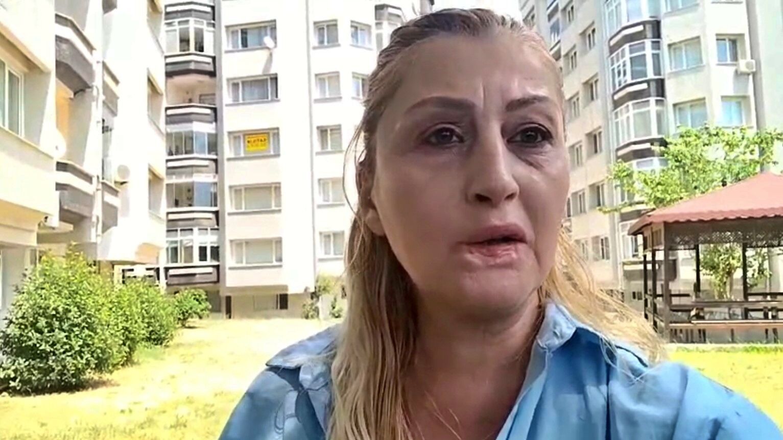 Antalya Estetik Dudagi Curudu1