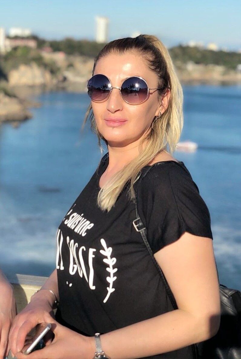 Antalya Estetik Dudagi Curudu4