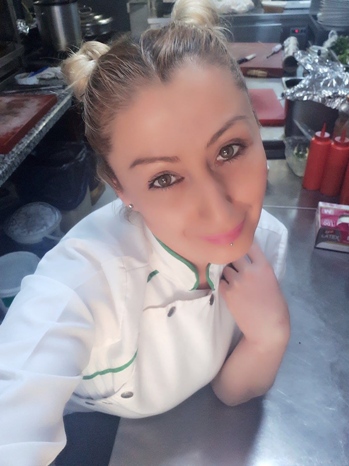 Antalya Estetik Dudagi Curudu5