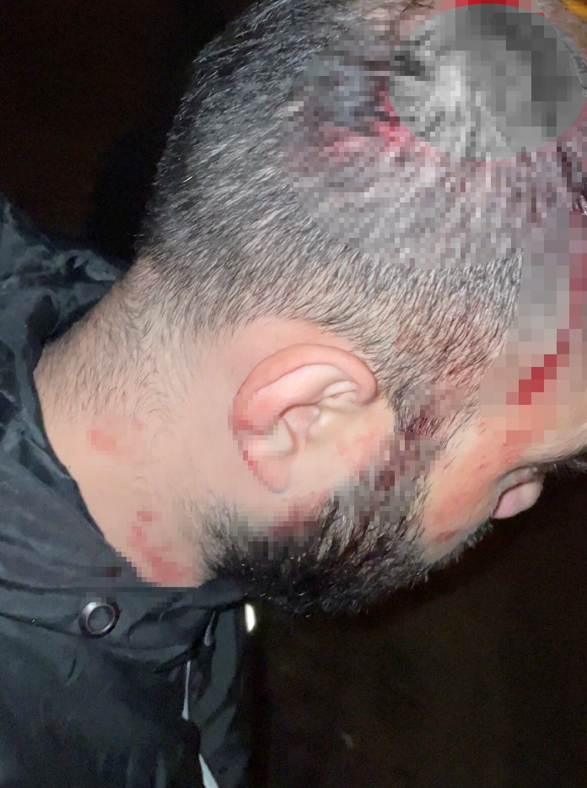 Antalya Kemer Yolu Kask Kamerasi Kaza4