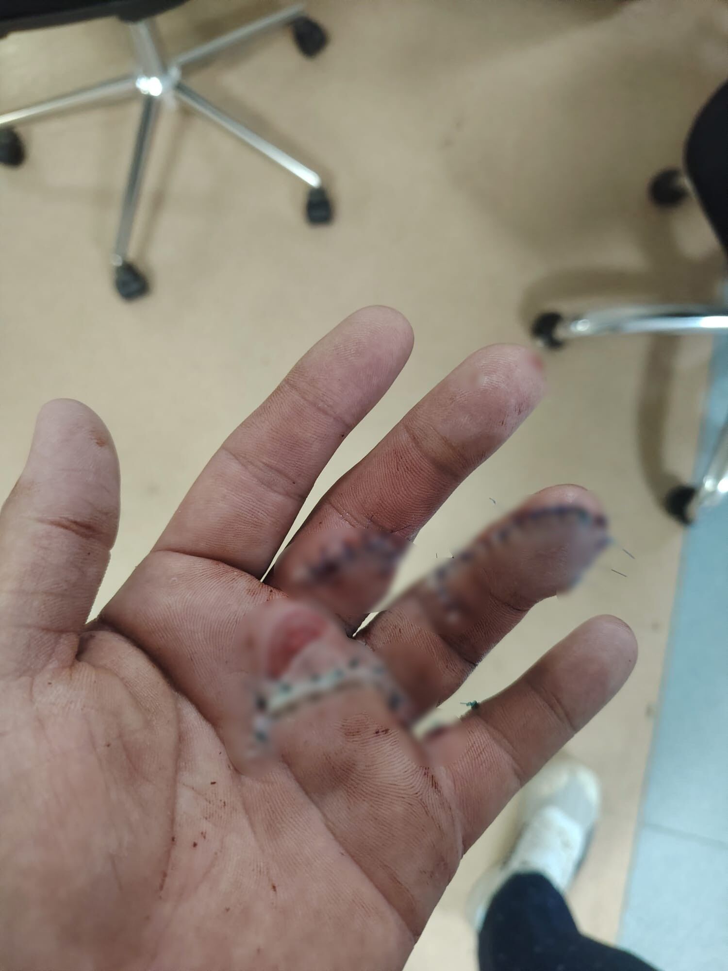 Semih Sungur Doner Bicakli Saldiri Konvoy Antalya6