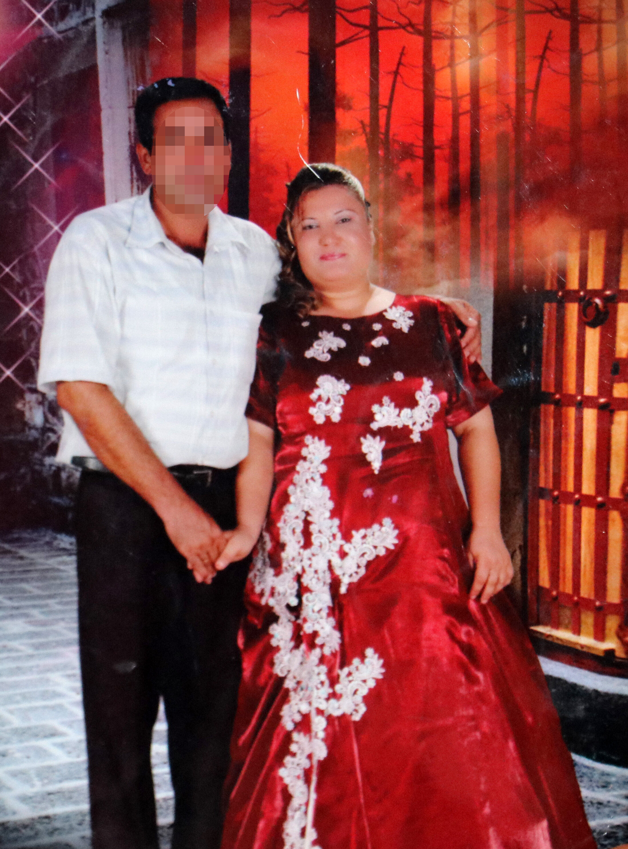 Yuksel Guzel Antalya Ameliyat3