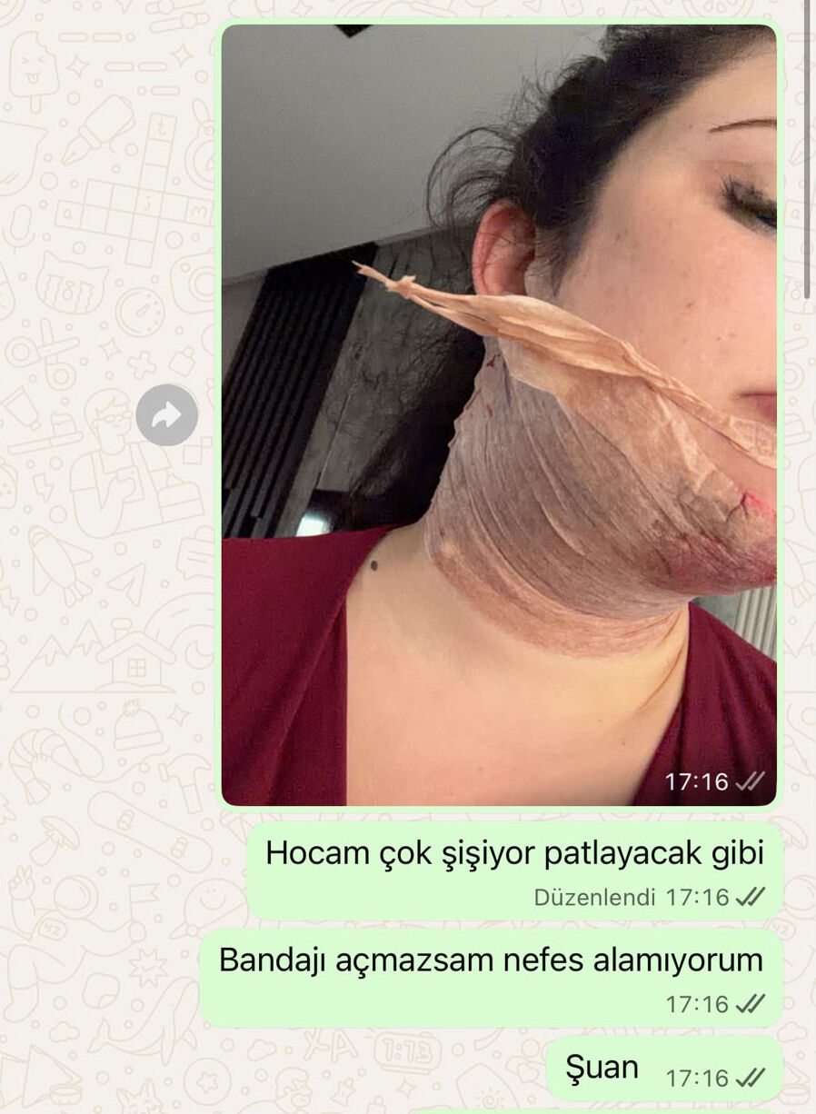 Estetik Ameliyat Antalya Dava Saglik2