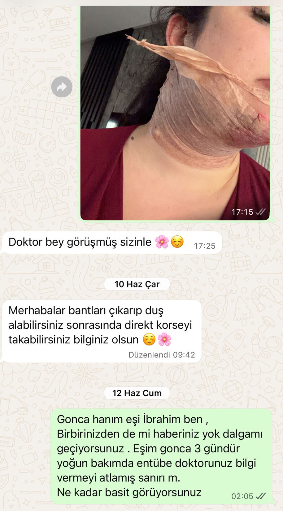 Estetik Ameliyat Antalya Dava Saglik3