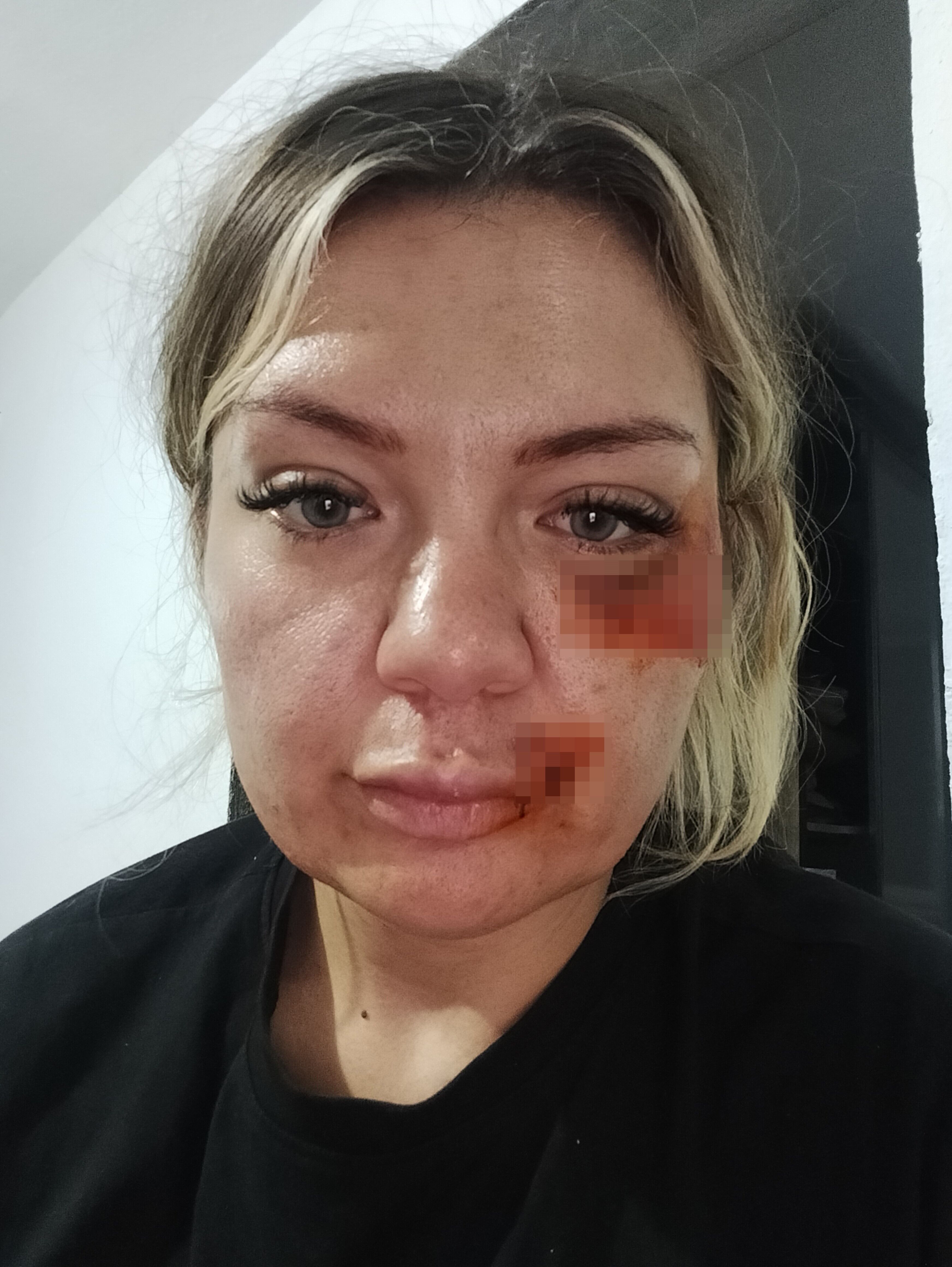 Ozge Celik Bicakli Saldiri Antalya Gazipasa Sorusturma2