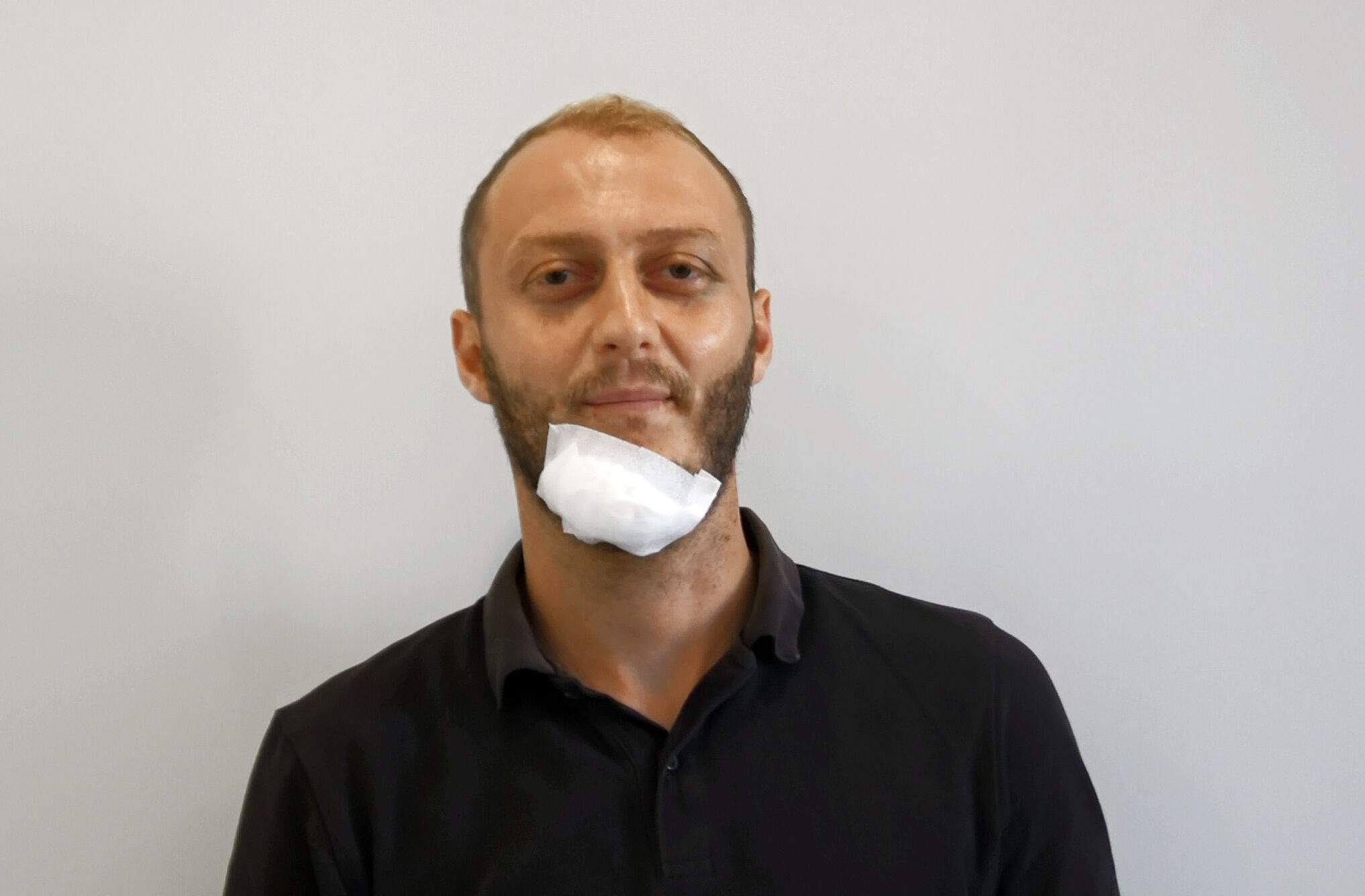 Serik Antalya Darp Musa Sahbaz