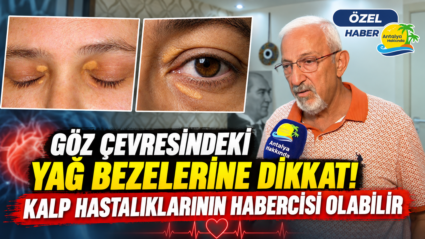 Göz çevresindeki yağ bezelerine dikkat! Kalp hastalıklarının habercisi olabilir