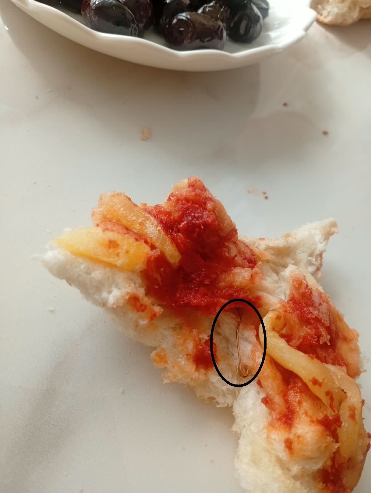 Antalya Ekmek Catal Igne Sikayet