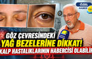 Göz çevresindeki yağ bezelerine dikkat! Kalp hastalıklarının habercisi olabilir