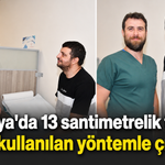Antalya'da 13 santimetrelik tümör ilk kez kullanılan yöntemle çıkarıldı!