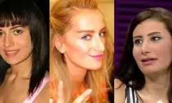 Ünlülerin Estetikle Değişimi Görenleri Şaşkına Çevirdi! İşte Öncesi ve Sonrasıyla Dikkat Çeken 10 İsim
