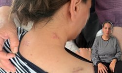 17 yerinden bıçaklandı ölü numarasıyla kurtuldu!