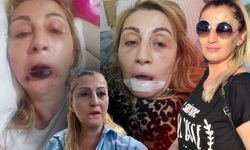 Antalya'da estetik işlem sonrası dudağı çürüdü: "Benim hakkımı kim arayacak?" diyerek isyan etti!
