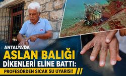 Antalya'da aslan balığı dikenleri eline battı: Profesörden sıcak su uyarısı!