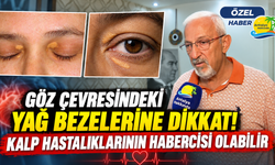 Göz çevresindeki yağ bezelerine dikkat! Kalp hastalıklarının habercisi olabilir