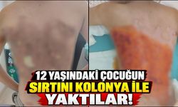 12 yaşındaki çocuğun sırtını kolonya ile yaktılar!