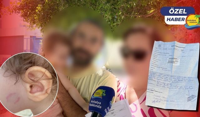 Antalya'daki gündüz bakımevinde skandal! 20 aylık Çağla bebeğin yanağındaki ısırık izini fondötenle örtbas etmişler! 