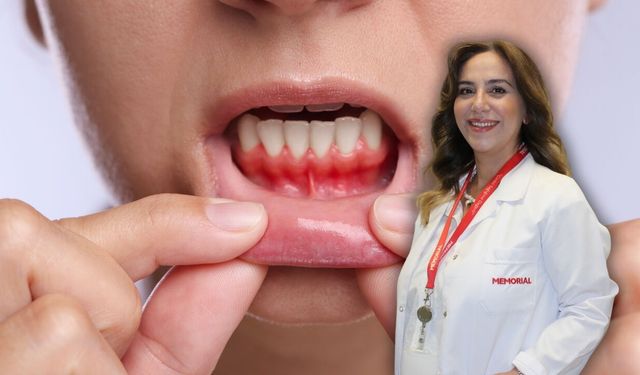 Antalya'da uzmanı açıkladı! İşte ağız içi yaralarının sebebi ve çözümü