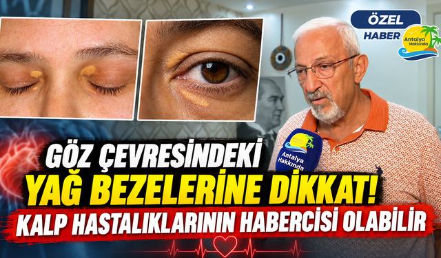 Göz çevresindeki yağ bezelerine dikkat! Kalp hastalıklarının habercisi olabilir