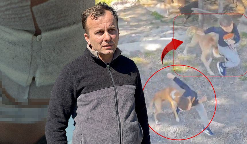 Antalya'da sokak köpeği saldırdı: Küçük çocuk hastanelik oldu!