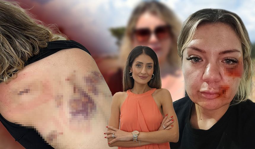Antalya'da dehşet saldırı sonrası konuştu: "Bıçak kırılmasaydı yaşama şansım yoktu"