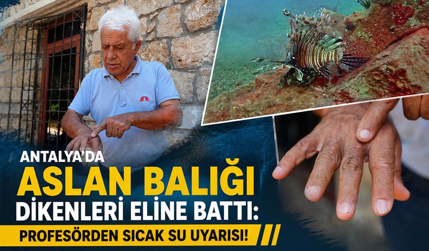 Antalya'da aslan balığı dikenleri eline battı: Profesörden sıcak su uyarısı!